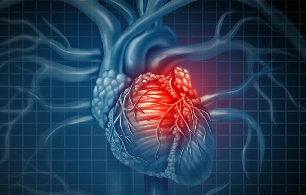 Graphic image of an enlarged heart with a blue background. Courtesy Getty Images.