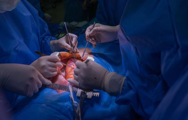 Close up photo of heart surgery, courtesy Getty Images.