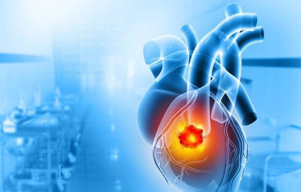 Graphic images of a heart with a tumor. Courtesy Getty Images.