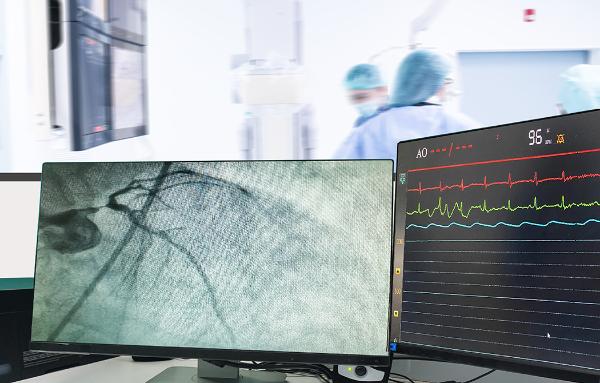 Monitor with cardiovascular imaging in foreground with team performing cardiac catheterization in the background. Courtesy Getty Images.